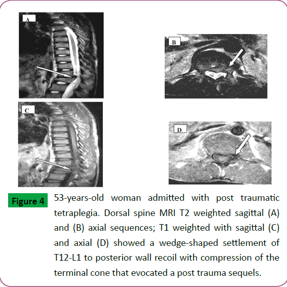 neurosciences-brain-imaging-post-trauma