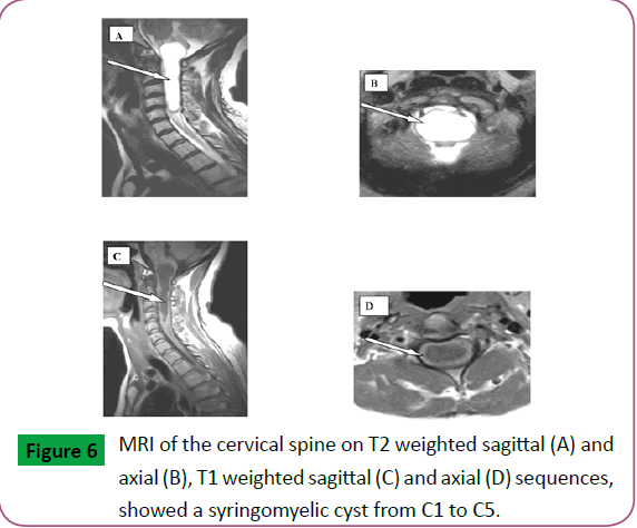 neurosciences-brain-imaging-weighted-sagittal