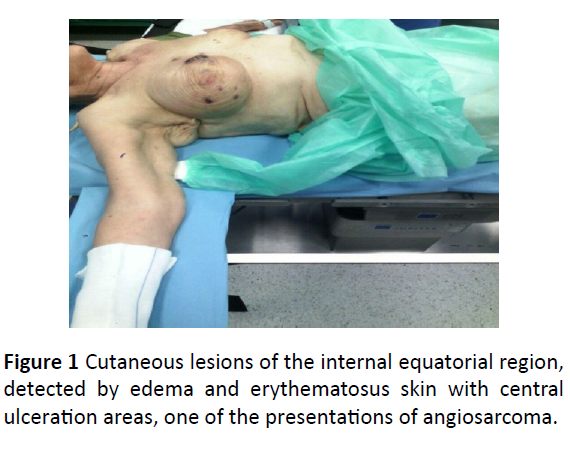 oncology-erythematosus-skin