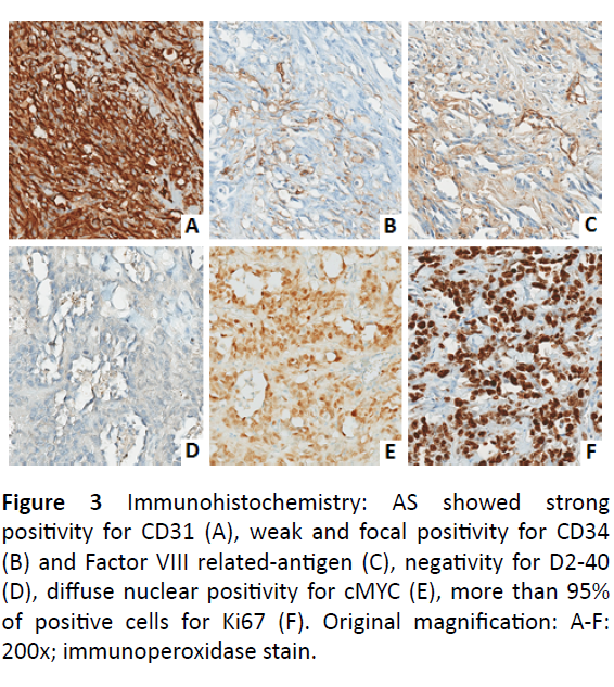 oncology-immunoperoxidase-stain