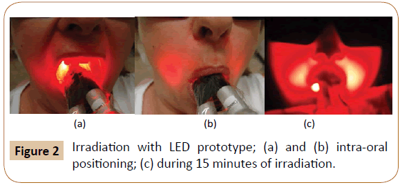 oral-medicine-irradiation-prototype-oral