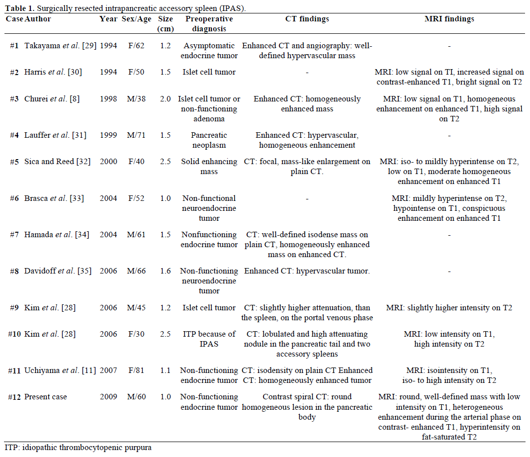 tABLE