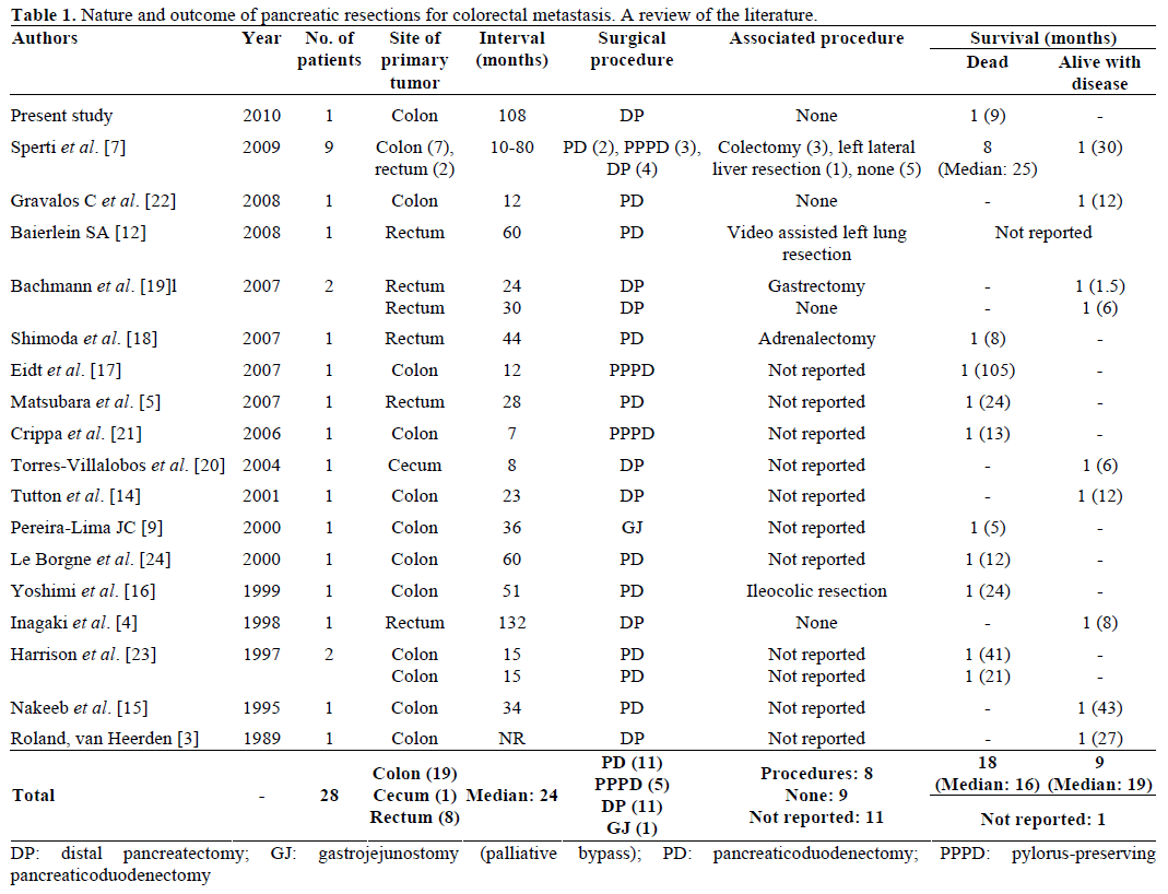 Table