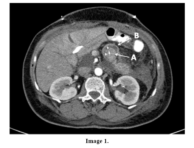 pancreas