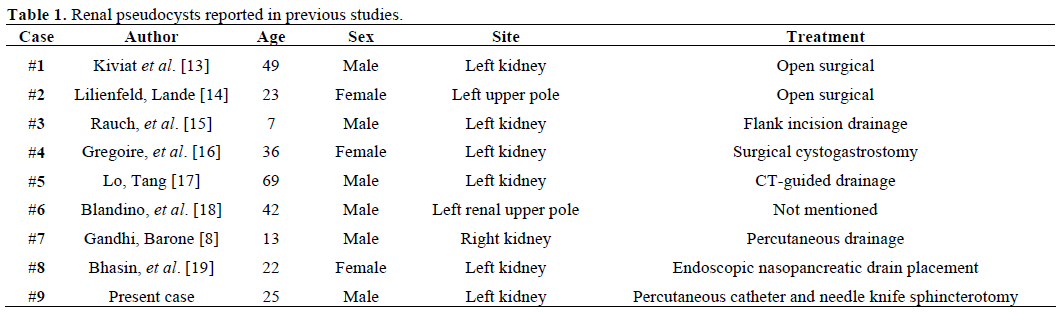 Table