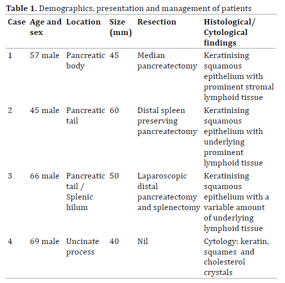 Table