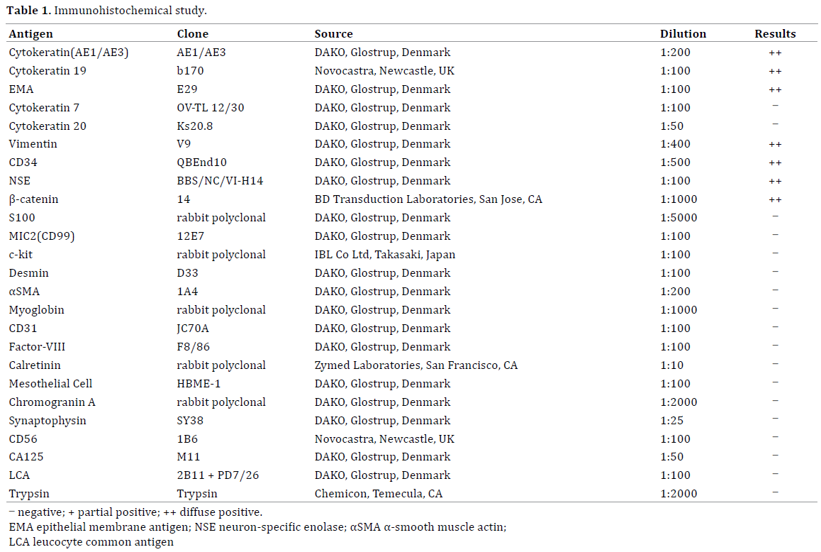 Table