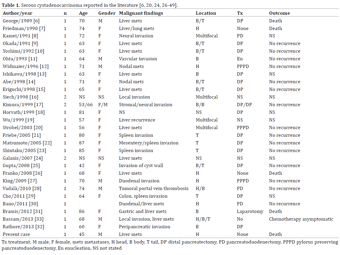 Table