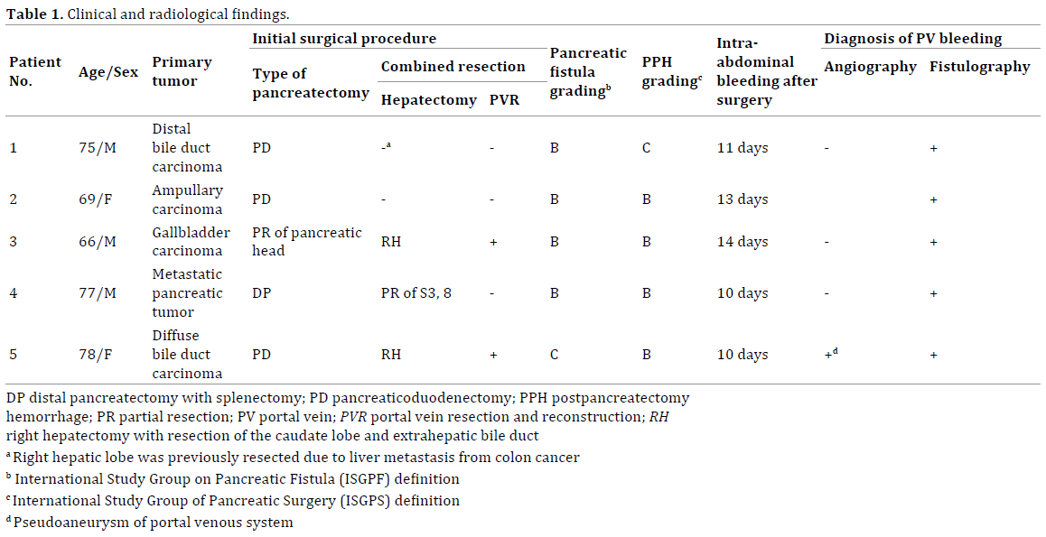 Table