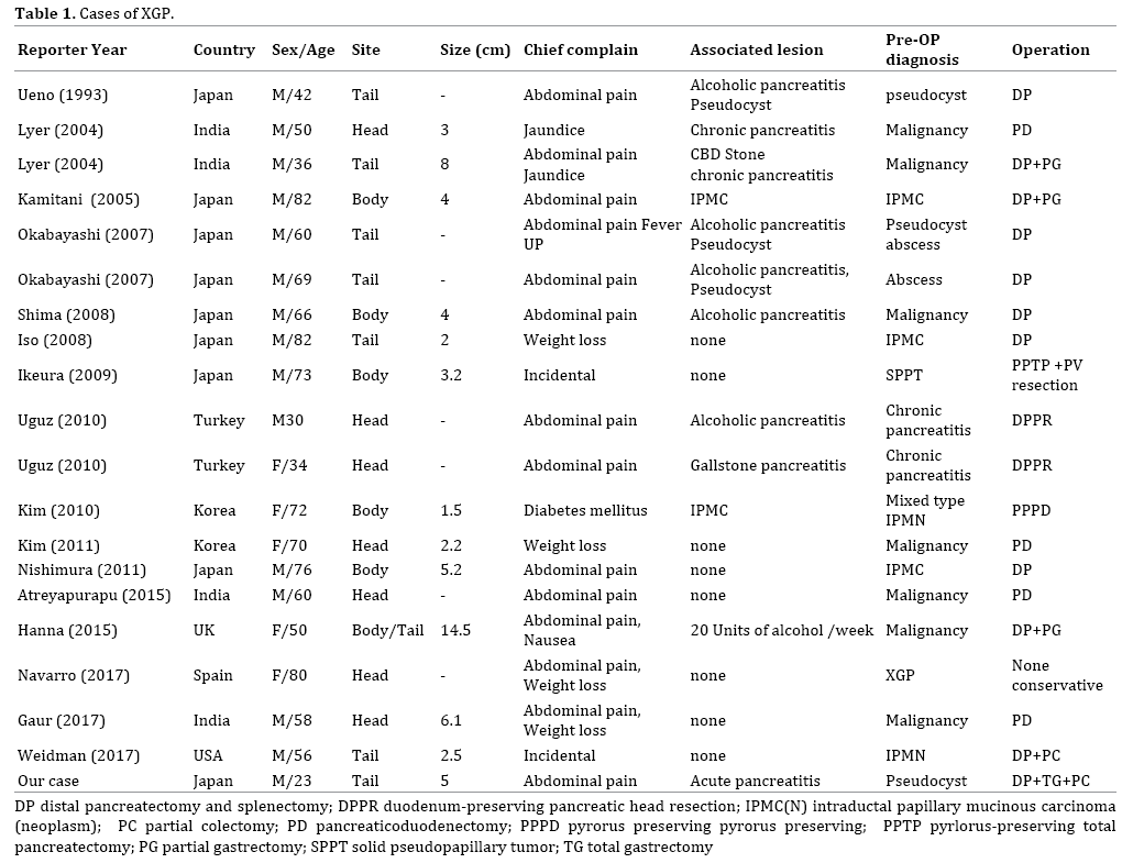 table