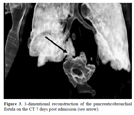 pancreas-3-dimentional-reconstruction