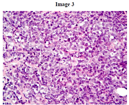 Write email commitment manly A Case of Primary Pancreatic Lymphoma