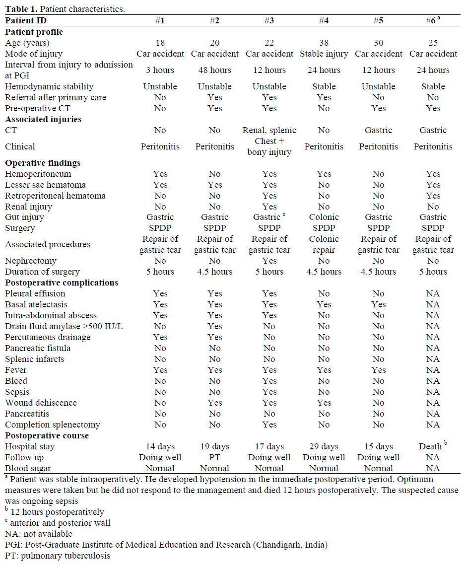 Table