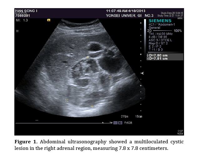 pancreas-Abdominal-ultrasonography