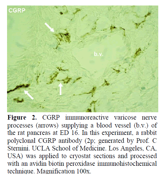 pancreas-CGRP-immunoreactive