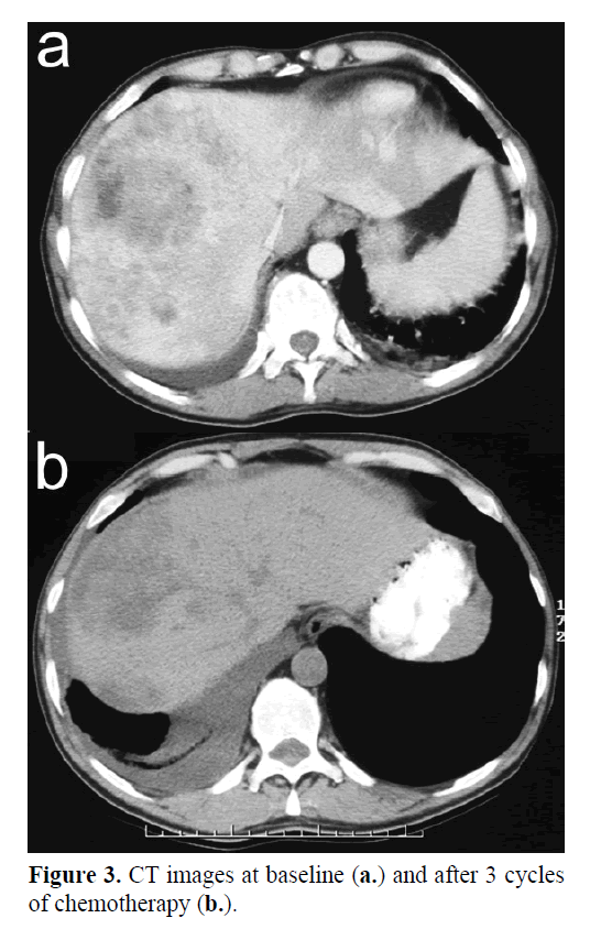 pancreas-CT-images-baseline
