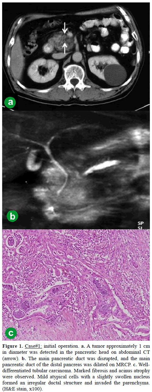 pancreas-Case1-initial-operation