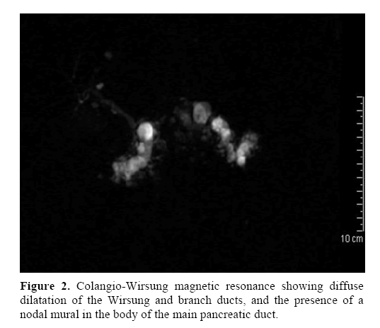 pancreas-Colangio-Wirsung-magnetic