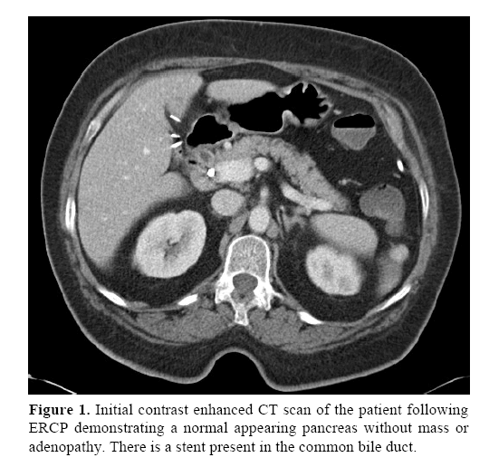 pancreas-ERCP-demonstrating