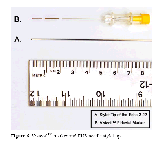 pancreas-EUS-needle-stylet-tip