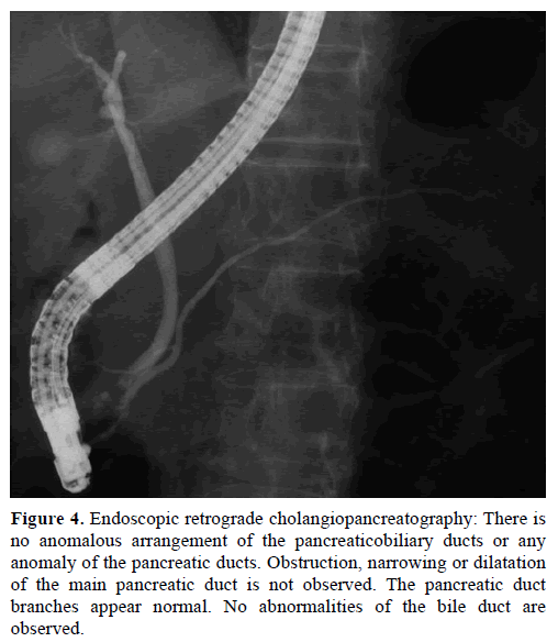 pancreas-Endoscopic-cholangiopancreatography