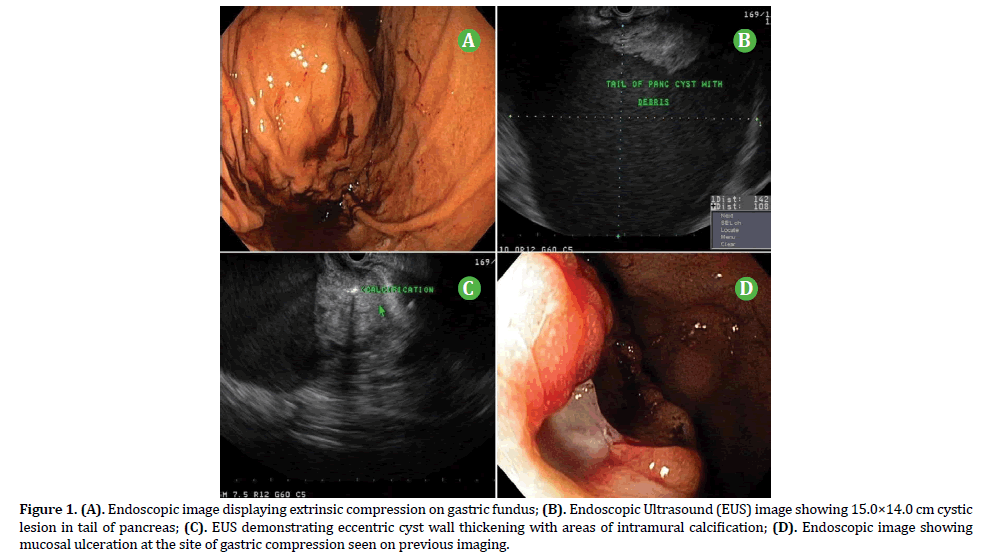 pancreas-Endoscopic-image