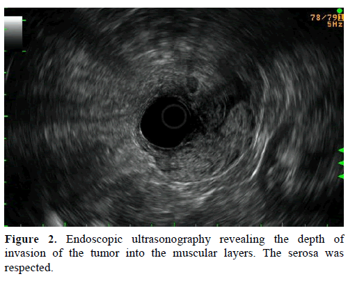 pancreas-Endoscopic-ultrasonography