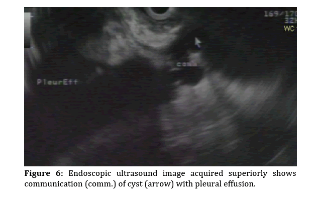pancreas-Endoscopic-ultrasound-image