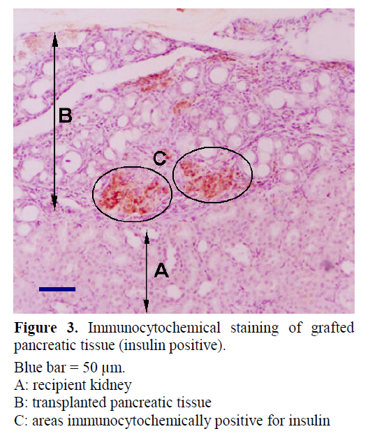 pancreas-Immunocytochemical-staining