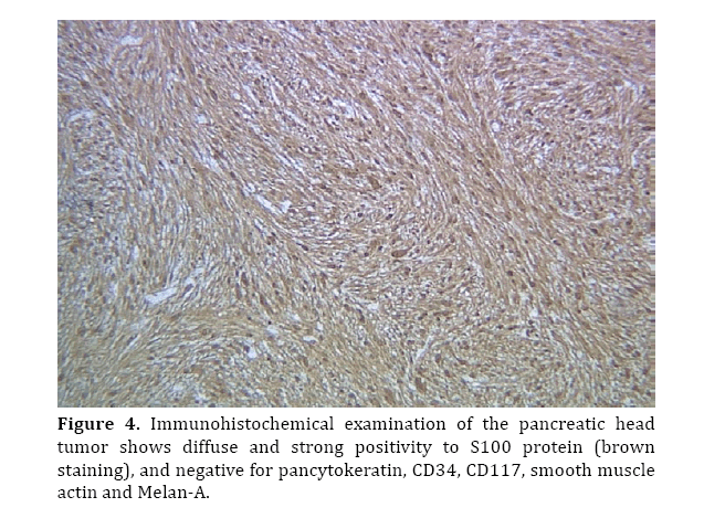 pancreas-Immunohistochemical-examination