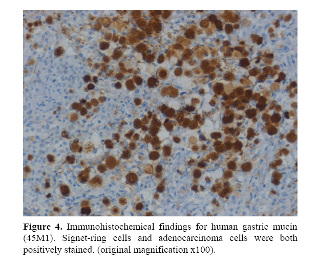 pancreas-Immunohistochemical-findings