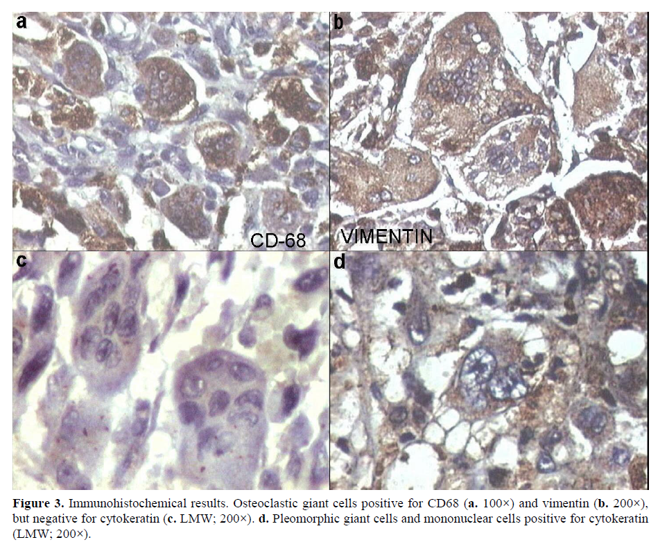 pancreas-Immunohistochemical-results