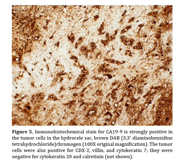 pancreas-Immunohistochemical-stain