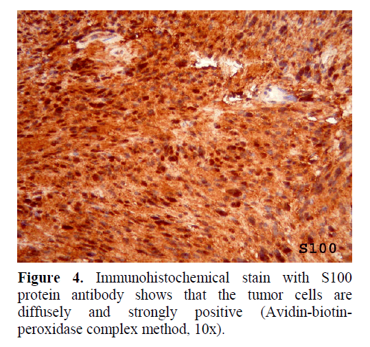 pancreas-Immunohistochemical-stain