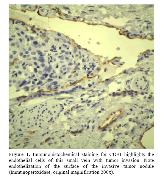 pancreas-Immunohistochemical-staining