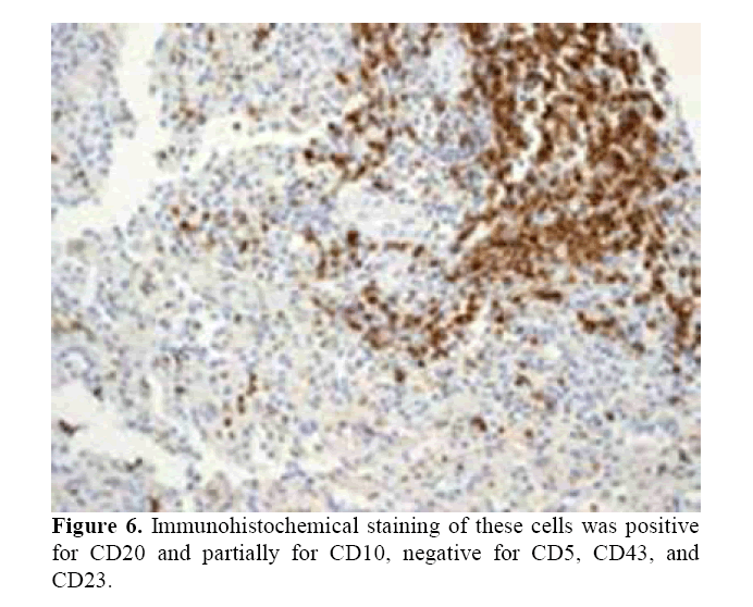 pancreas-Immunohistochemical-staining
