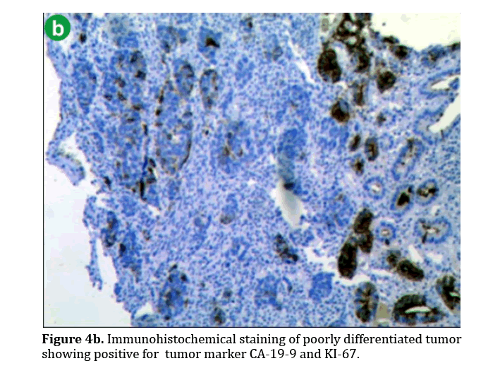 pancreas-Immunohistochemical-staining