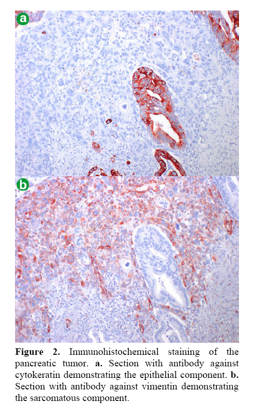 pancreas-Immunohistochemical-staining