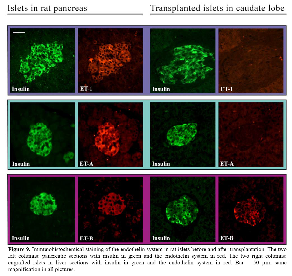 pancreas-Immunohistochemical-staining