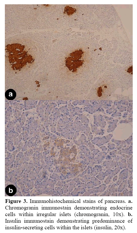 pancreas-Immunohistochemical-stains
