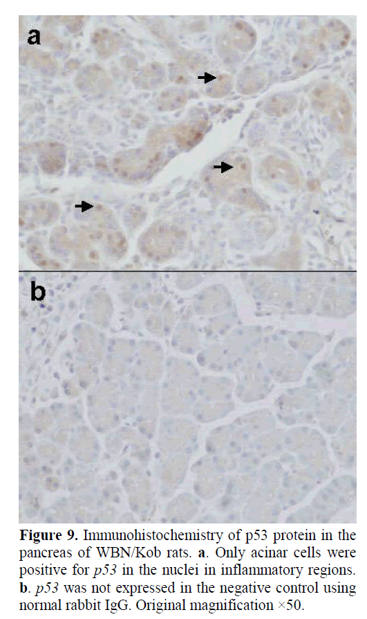 pancreas-Immunohistochemistry-p53-protein