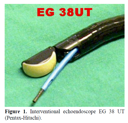 pancreas-Interventional-echoendoscope