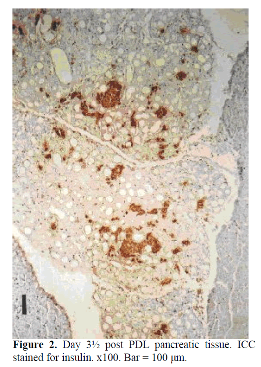 pancreas-PDL-pancreatic-tissue