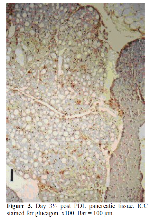 pancreas-PDL-pancreatic-tissue