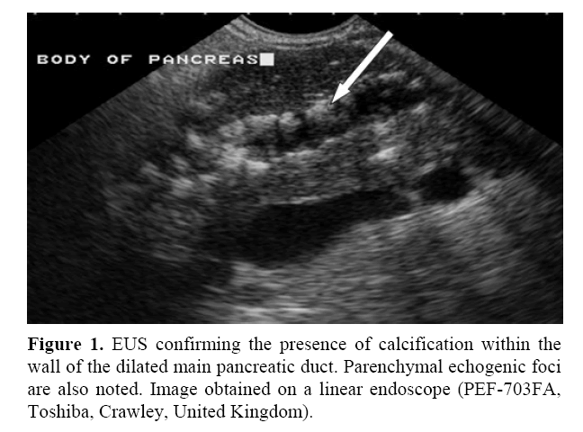 pancreas-Parenchymal-echogenic