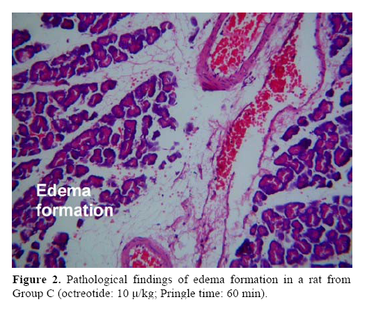 pancreas-Pathological-findings