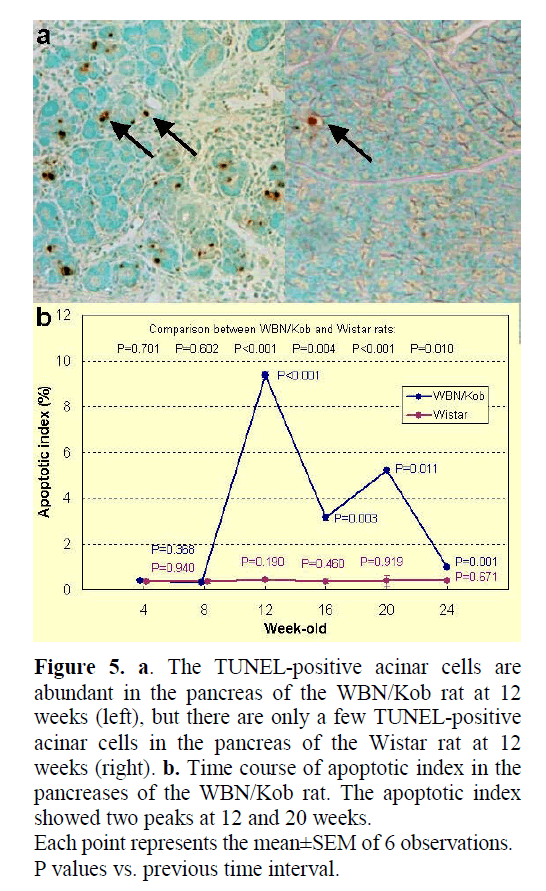 pancreas-TUNEL-positive-acinar-cells