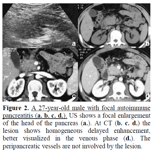 pancreas-a-27-year-old-male