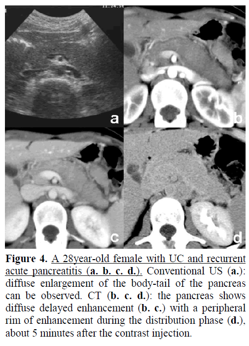 pancreas-a-28-year-old-female