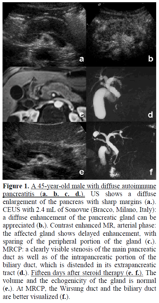 pancreas-a-45-year-old-male